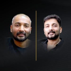HT Before & After (3)